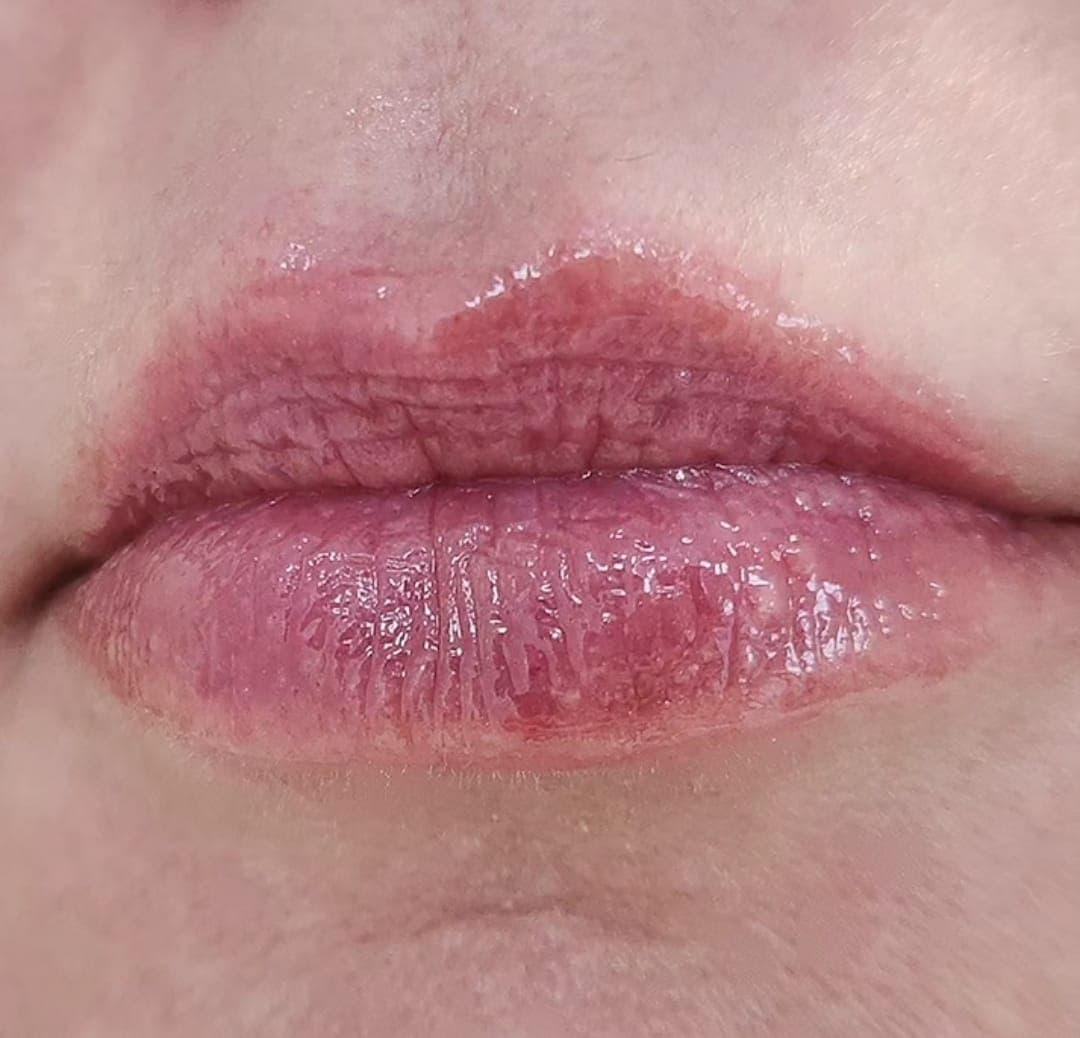 Tratamento GlowLips